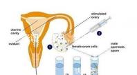降調(diào)，進周，囊胚……這些試管嬰兒助孕術(shù)語你都懂嗎？